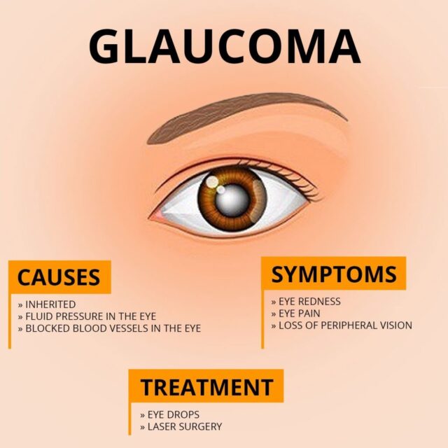 Best Glaucoma Treatment In Dubai Eye Consultants