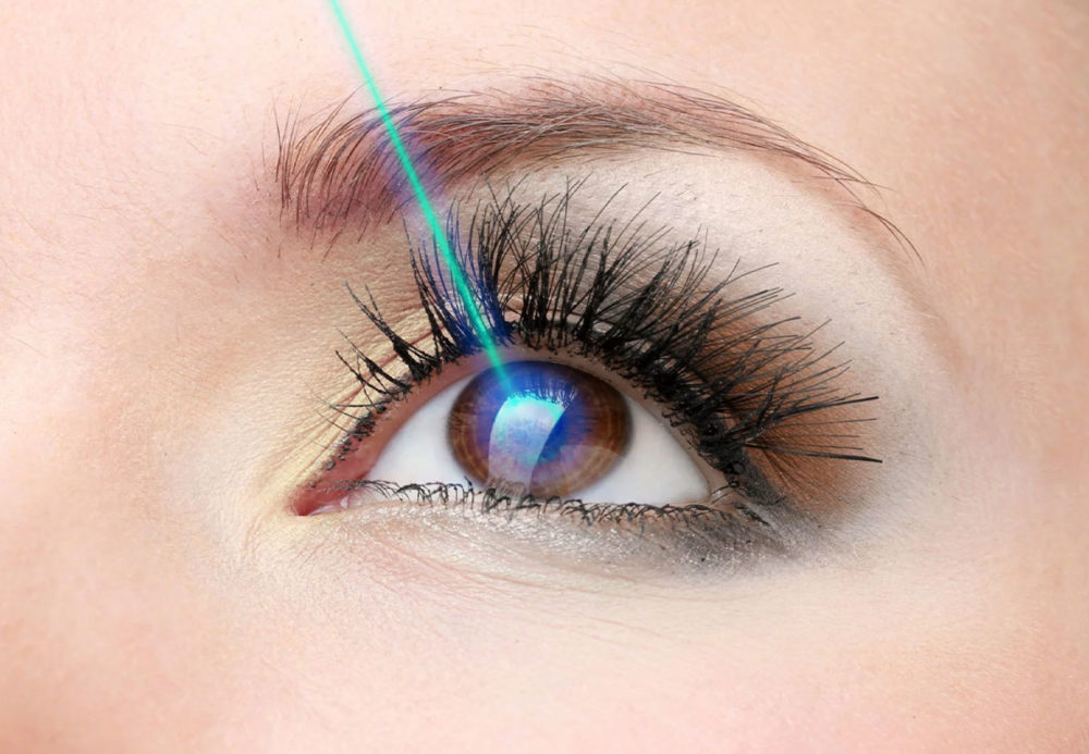 About LASIK Surgery