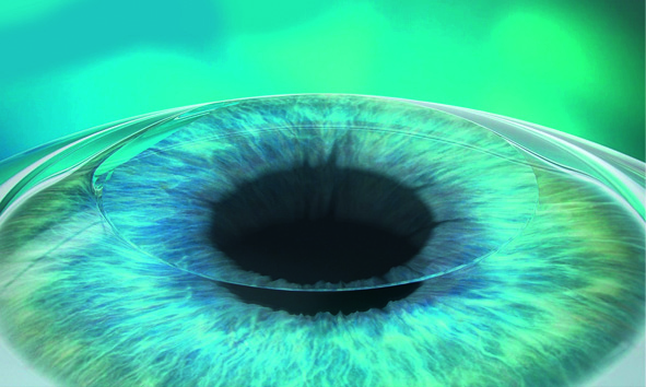 Lasic Refractive Surgery in Dubai | Eye Consultants