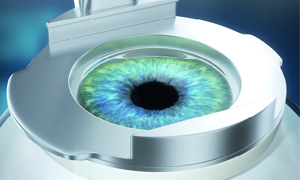 Lasik Refractive Surgery in Dubai | Eye Consultants