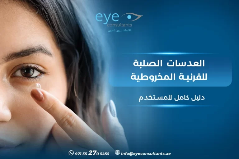 العدسات الصلبة للقرنية المخروطية