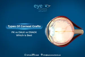 Types of Corneal Grafts: PK vs DALK vs DSAEK Which is Best