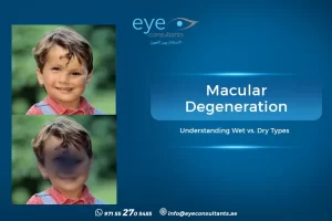 Macular Degeneration: Understanding Wet vs. Dry Types