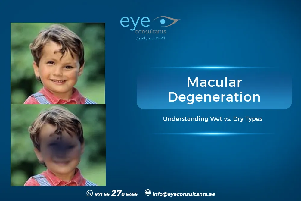 Wet vs Dry Macular Degeneration