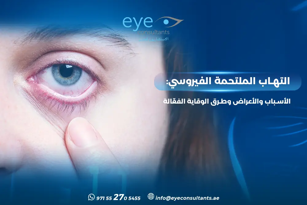 التهاب الملتحمة الفيروسي