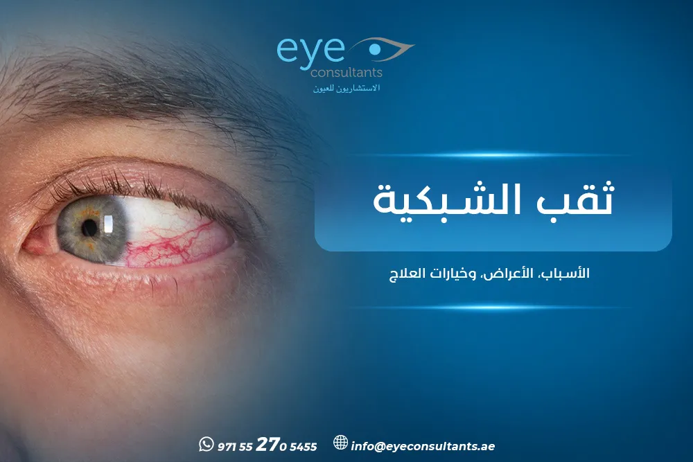 ثقب الشبكية