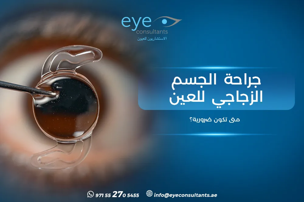 جراحة الجسم الزجاجي للعين