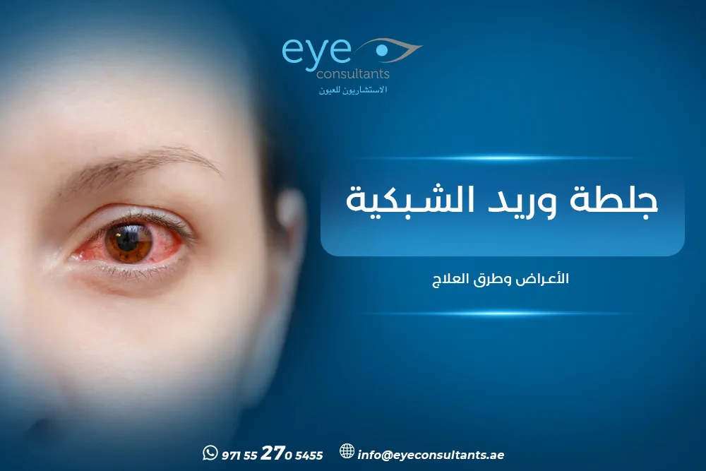 جلطة وريد الشبكية