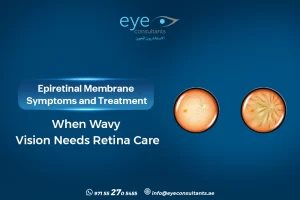 Epiretinal Membrane Symptoms and Treatment – When Wavy Vision Needs Retina Care