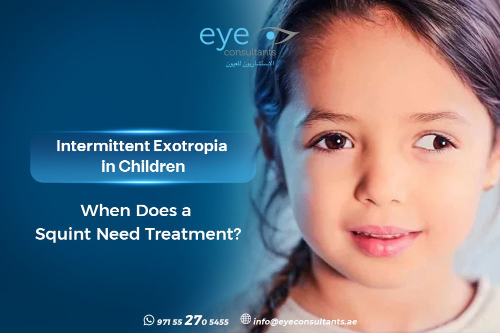 intermittent exotropia in children