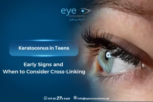 Keratoconus For Teenagers – Early Signs and When to Consider Cross-Linking
