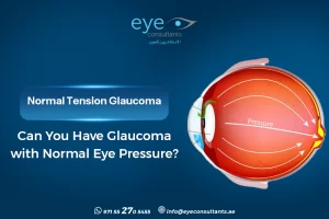 Normal Tension Glaucoma – Can You Have Glaucoma with Normal Eye Pressure?