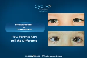 Pseudo Strabismus vs True Strabismus – How Parents Can Tell the Difference