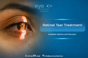 Retinal Tear Treatment Available Options and Recovery