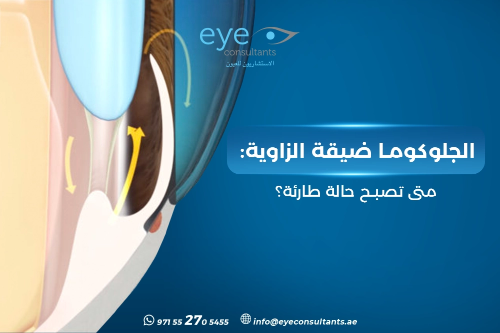 الجلوكوما ضيقة الزاوية