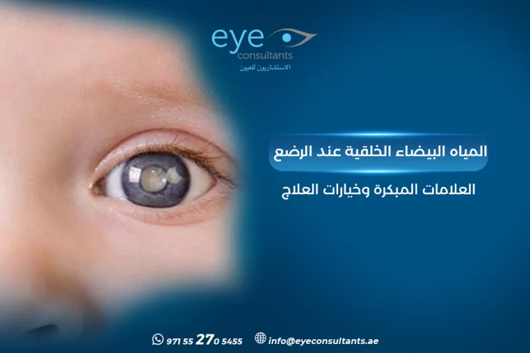 المياه البيضاء الخلقية عند الرضع