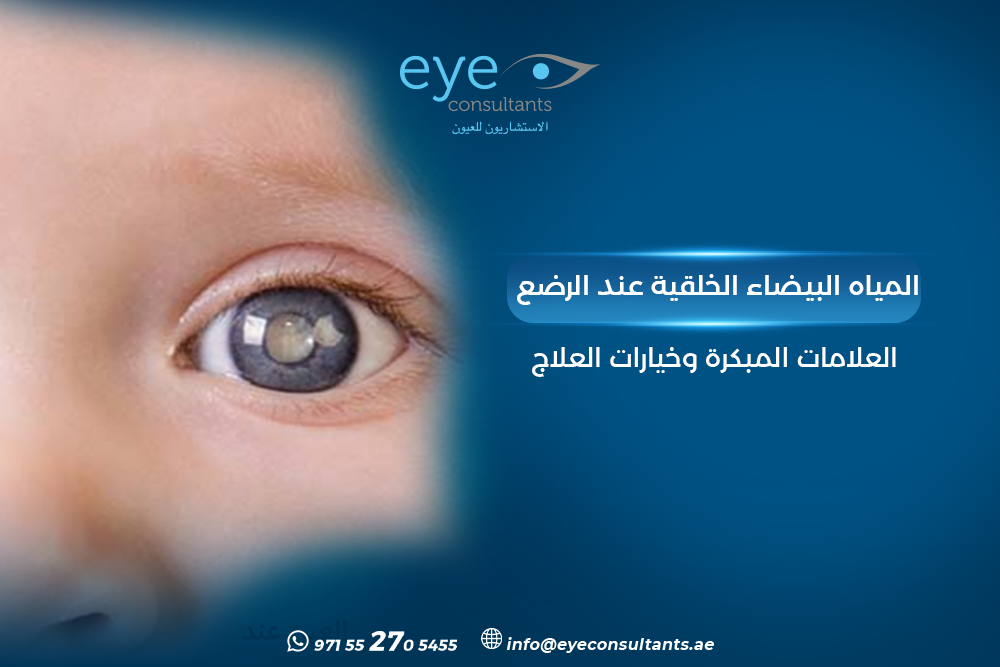 المياه البيضاء الخلقية عند الرضع