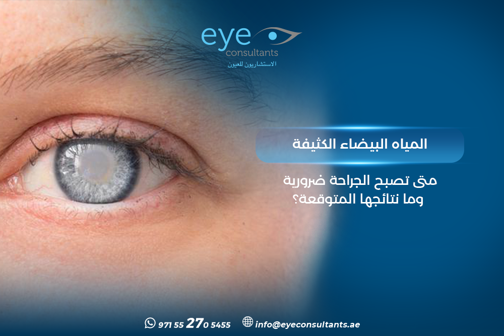 المياه البيضاء الكثيفة