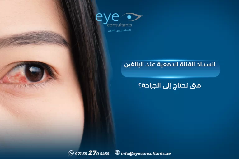 انسداد القناة الدمعية عند البالغين