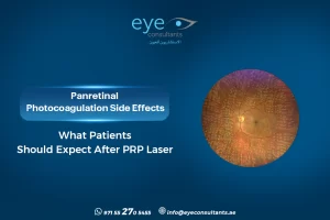 Panretinal Photocoagulation Side Effects What Patients Should Expect After PRP Laser