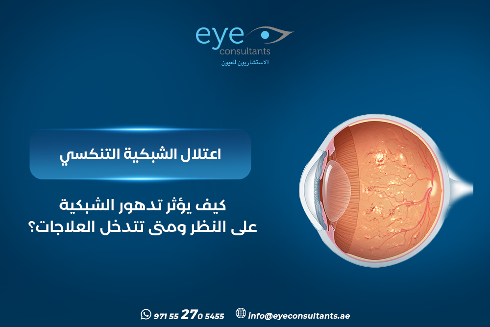 اعتلال الشبكية التنكسي