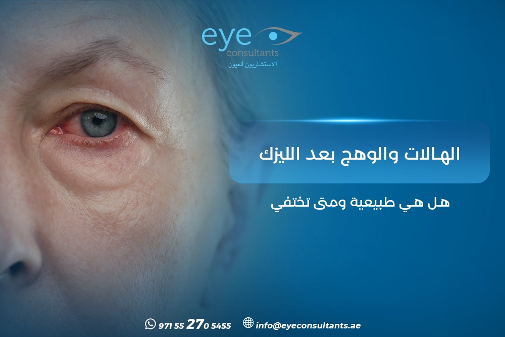 الهالات والوهج بعد الليزك