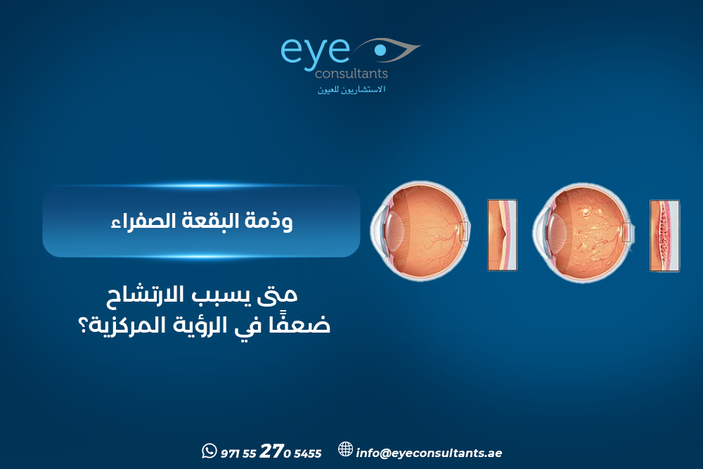 وذمة البقعة الصفراء