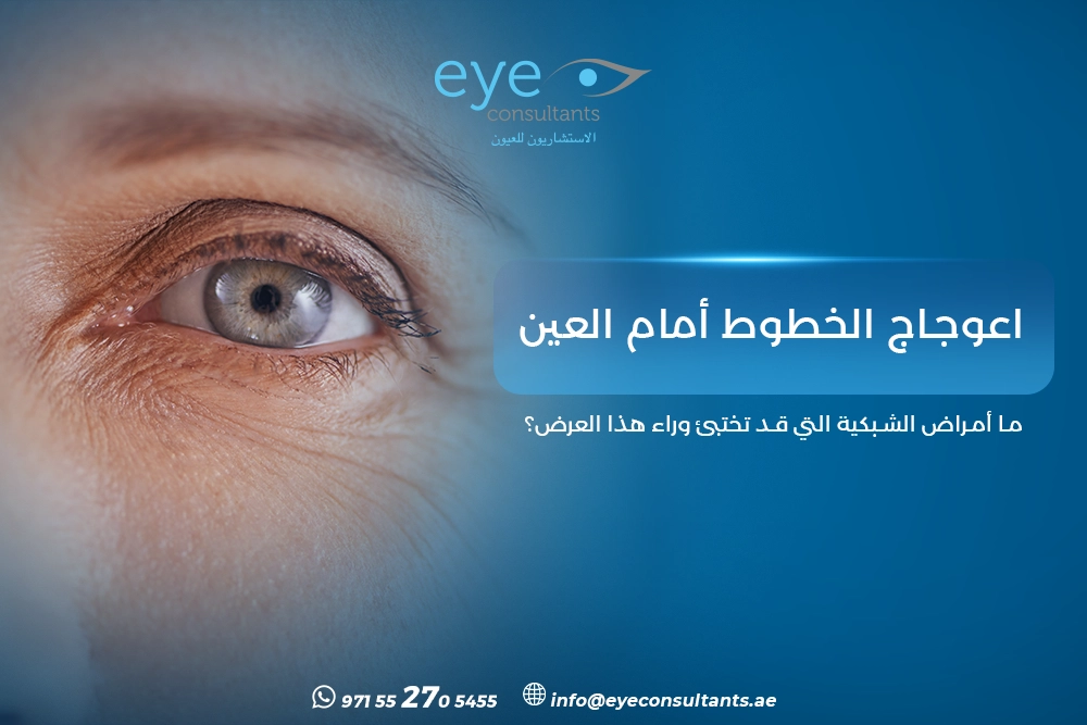 اعوجاج الخطوط أمام العين