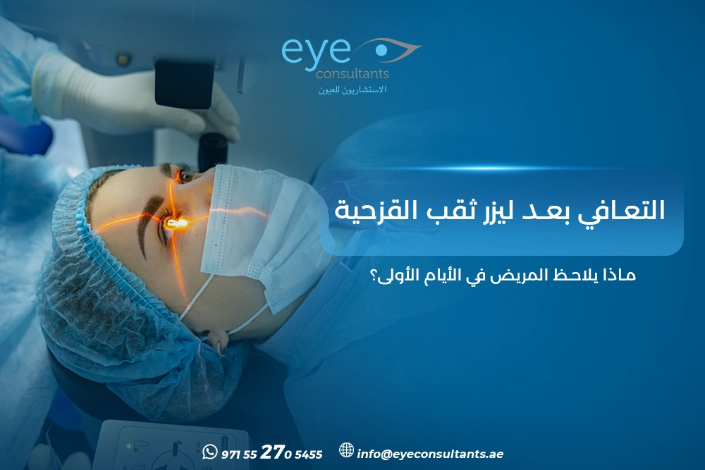 التعافي بعد ليزر ثقب القزحية