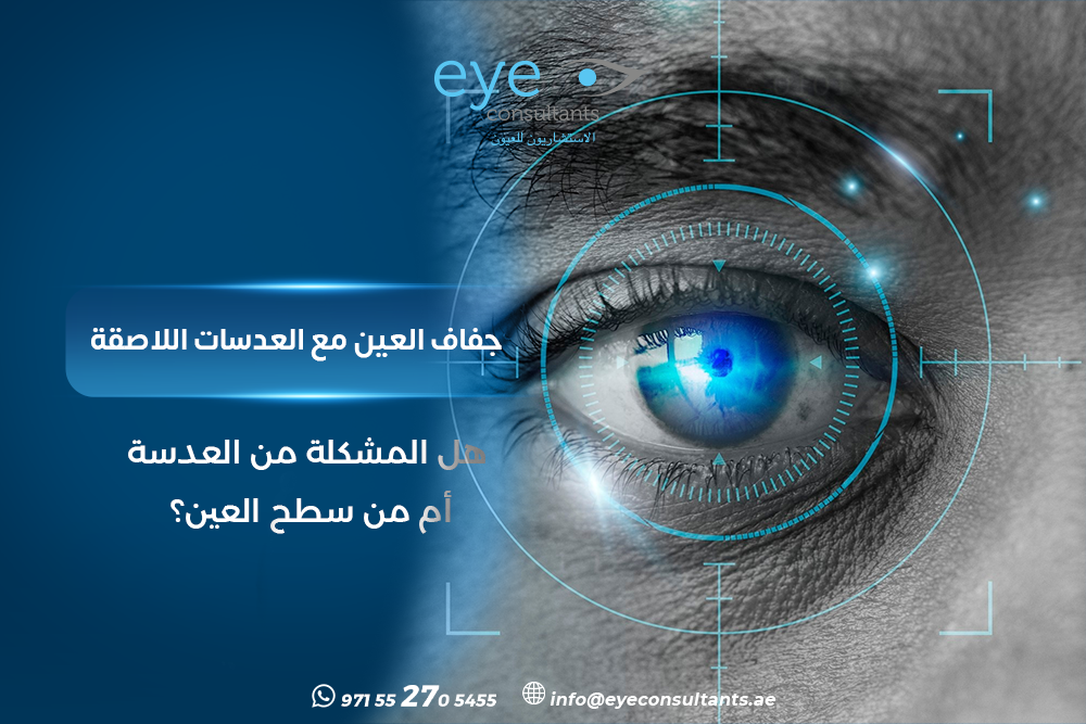 جفاف العين مع العدسات اللاصقة