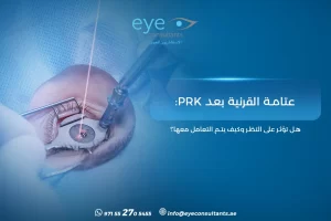 عتامة القرنية بعد PRK: هل تؤثر على النظر وكيف يتم التعامل معها؟