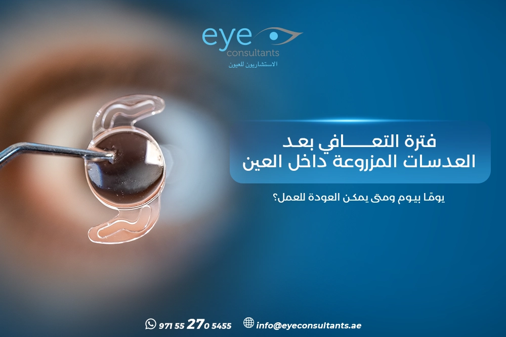 فترة التعافي بعد العدسات المزروعة