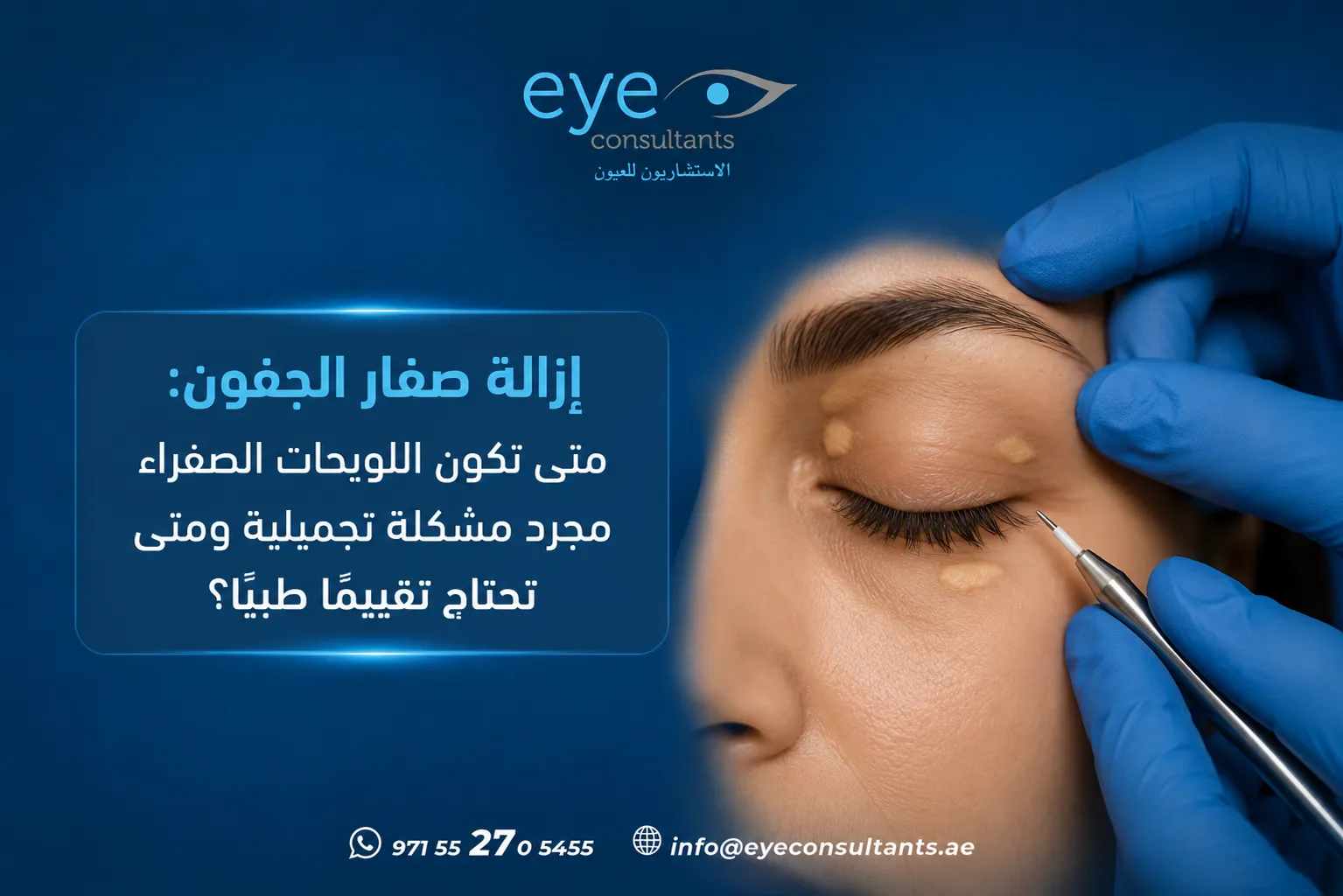 إزالة صفار الجفون