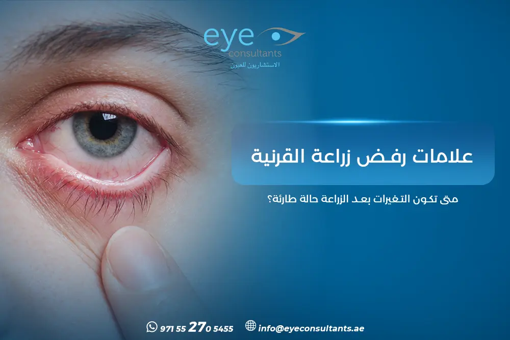 علامات رفض زراعة القرنية