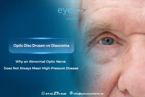 Optic Disc Drusen vs Glaucoma – Why an Abnormal Optic Nerve Does Not Always Mean High-Pressure Disease