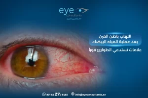 التهاب باطن العين بعد عملية المياه البيضاء – علامات تستدعي الطوارئ فورًا