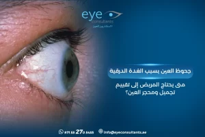 جحوظ العين بسبب الغدة الدرقية – متى يحتاج المريض إلى تقييم تجميل ومحجر العين؟