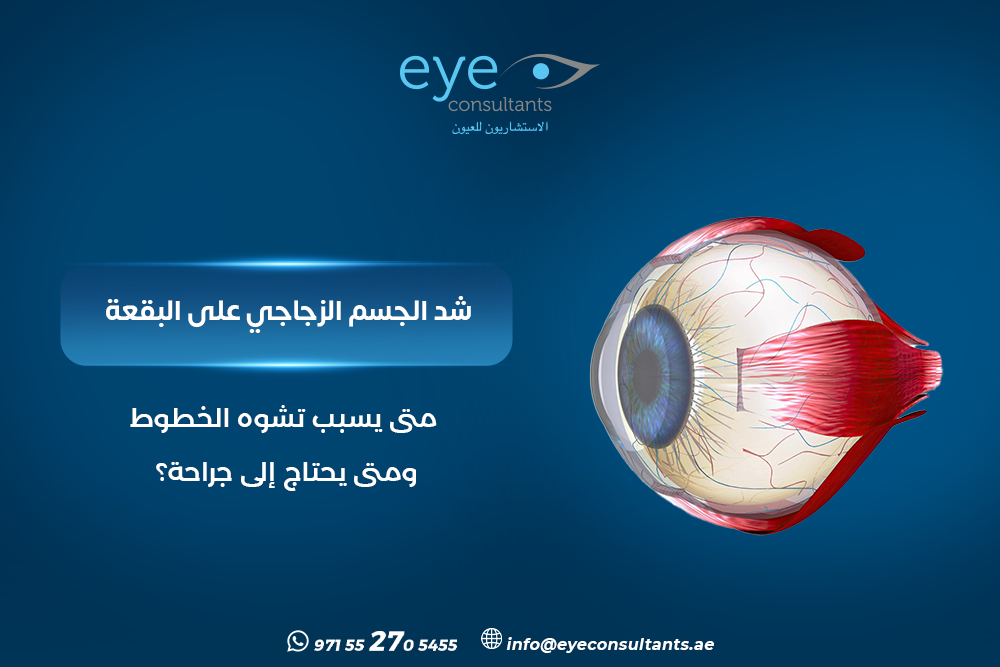 شد الجسم الزجاجي على البقعة