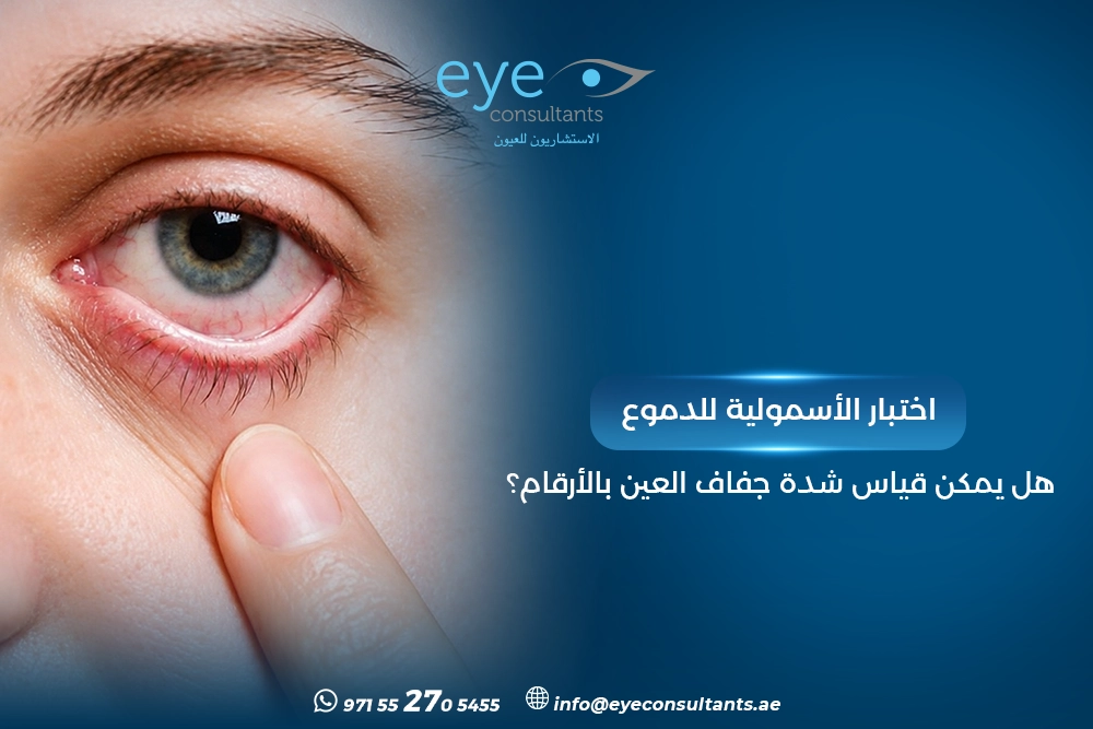 اختبار الأسمولية للدموع