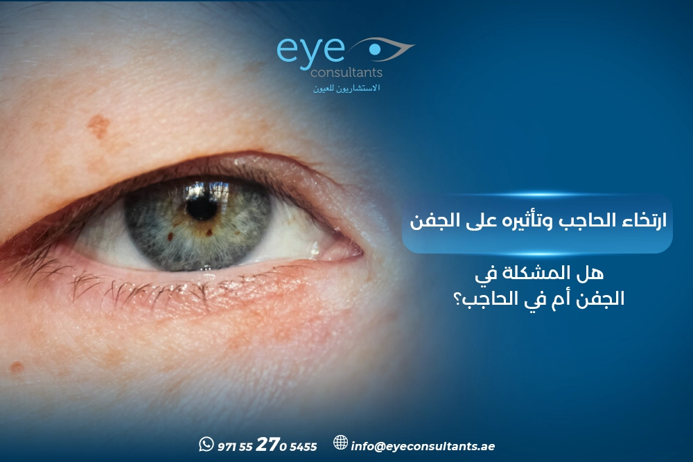 ارتخاء الحاجب وتأثيره على الجفن