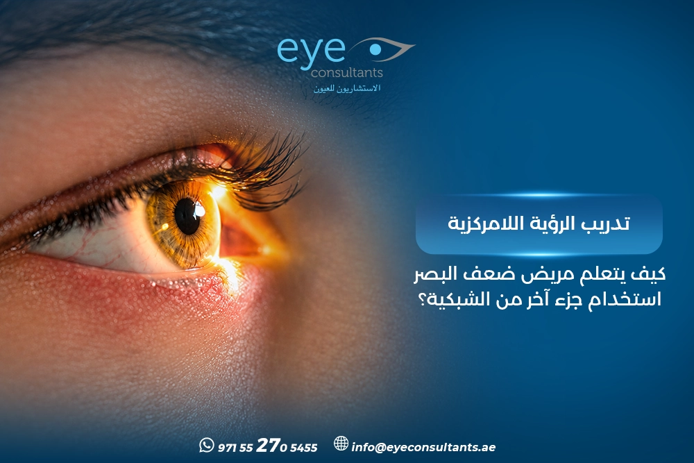تدريب الرؤية اللامركزية