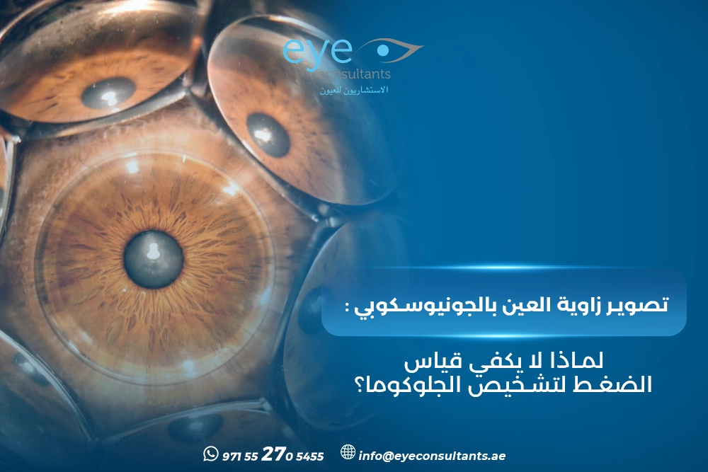 تصوير زاوية العين بالجونيوسكوبي