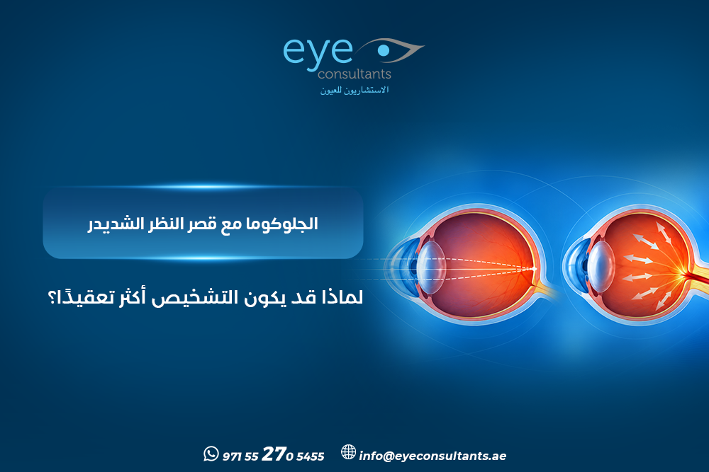 الجلوكوما مع قصر النظر