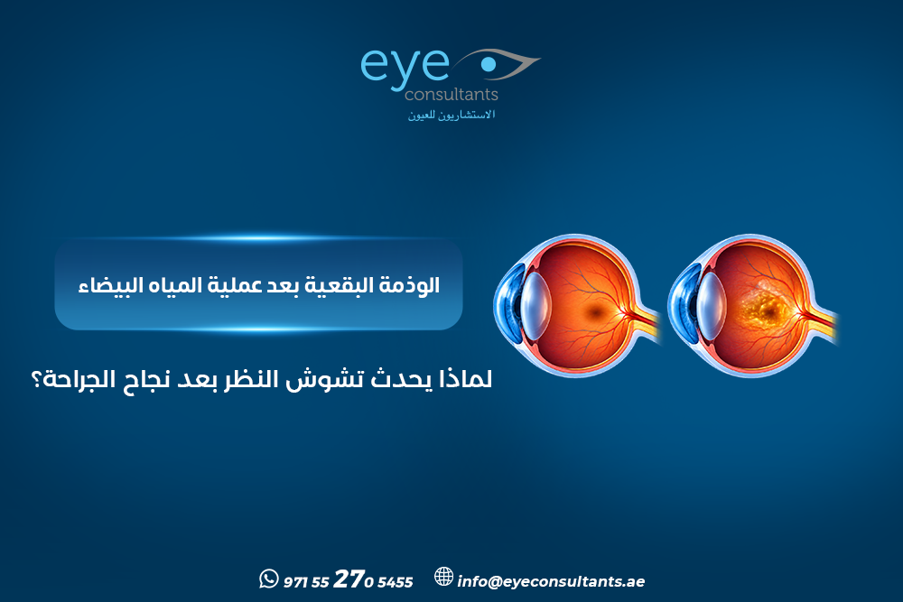 الوذمة البقعية